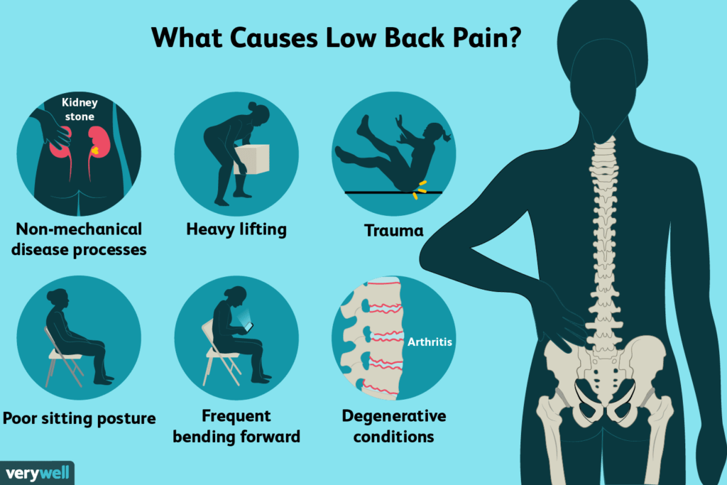 What disease starts with lower back pain?